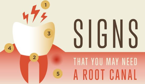 Signs for a root canal