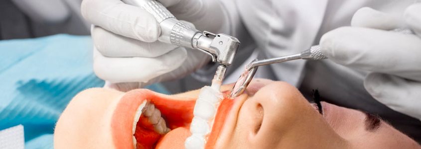 new westminster dental cleaning