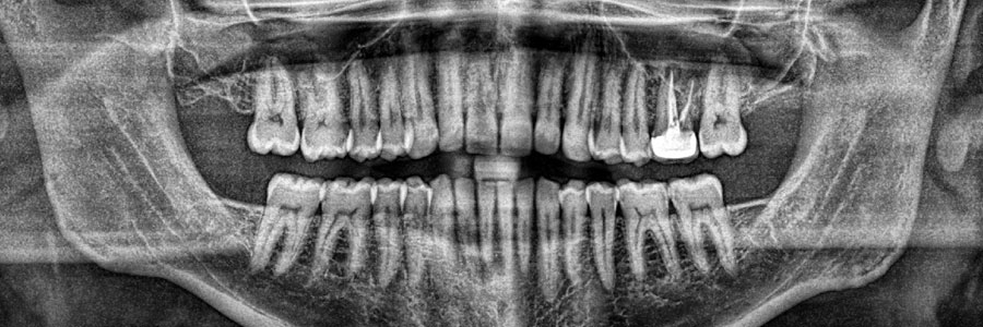 new westminster dental x ray